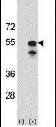 CPN1 Antibody in Western Blot (WB)