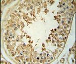CPNE8 Antibody in Immunohistochemistry (IHC)