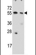 CPNE8 Antibody in Western Blot (WB)