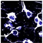 CPP Binding Protein Antibody in Immunohistochemistry (IHC)