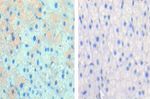 CPT1A Antibody in Immunohistochemistry (IHC)