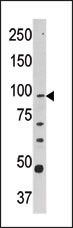 CPT1A Antibody in Western Blot (WB)