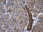 CPT1B Antibody in Immunohistochemistry (Paraffin) (IHC (P))