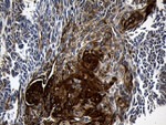 CPT1B Antibody in Immunohistochemistry (Paraffin) (IHC (P))