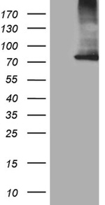 CPT1B Antibody in Western Blot (WB)