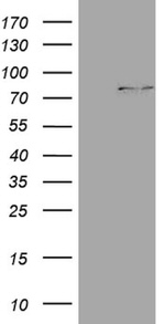 CPT1B Antibody in Western Blot (WB)