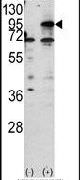 CPT1B Antibody in Western Blot (WB)