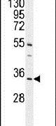 C18orf25 Antibody in Western Blot (WB)