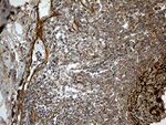 CR1 Antibody in Immunohistochemistry (Paraffin) (IHC (P))