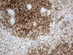 CR1 Antibody in Immunohistochemistry (Paraffin) (IHC (P))