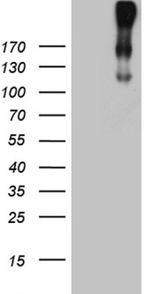 CR1 Antibody in Western Blot (WB)