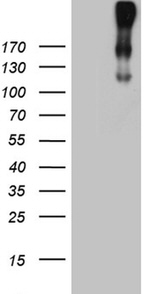 CR1 Antibody in Western Blot (WB)