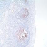 CD21 Antibody in Immunohistochemistry (IHC)