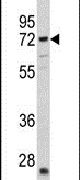 CAT1 Antibody in Western Blot (WB)