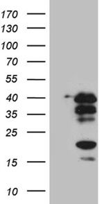 CREM Antibody in Western Blot (WB)