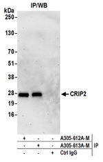 CRIP2 Antibody in Western Blot (WB)