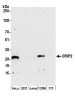 CRIP2 Polyclonal Antibody
