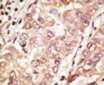 Cripto Antibody in Immunohistochemistry (IHC)