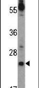 Cripto Antibody in Western Blot (WB)