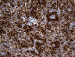 CRLF3 Antibody in Immunohistochemistry (Paraffin) (IHC (P))