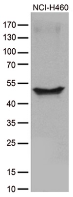 CRLF3 Antibody in Western Blot (WB)