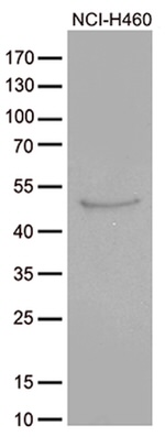 CRLF3 Antibody in Western Blot (WB)