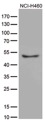 CRLF3 Antibody in Western Blot (WB)