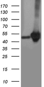 CRLF3 Antibody in Western Blot (WB)