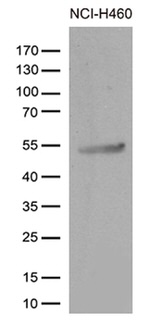 CRLF3 Antibody in Western Blot (WB)