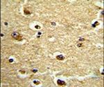 CROT Antibody in Immunohistochemistry (IHC)