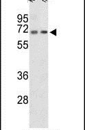 CROT Antibody in Western Blot (WB)