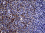 CRP Antibody in Immunohistochemistry (Paraffin) (IHC (P))