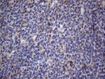 CRP Antibody in Immunohistochemistry (Paraffin) (IHC (P))