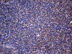 CRP Antibody in Immunohistochemistry (Paraffin) (IHC (P))