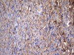 CRP Antibody in Immunohistochemistry (Paraffin) (IHC (P))
