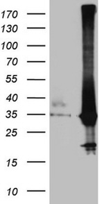 CRP Antibody in Western Blot (WB)