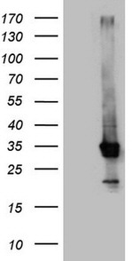 CRP Antibody in Western Blot (WB)