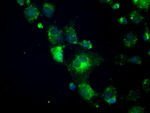 CRYAB Antibody in Immunocytochemistry (ICC/IF)