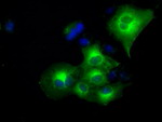 CRYAB Antibody in Immunocytochemistry (ICC/IF)