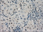 CRYAB Antibody in Immunohistochemistry (Paraffin) (IHC (P))