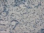 CRYAB Antibody in Immunohistochemistry (Paraffin) (IHC (P))