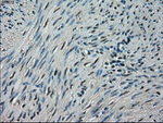 CRYAB Antibody in Immunohistochemistry (Paraffin) (IHC (P))