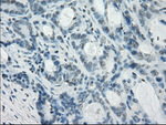 CRYAB Antibody in Immunohistochemistry (Paraffin) (IHC (P))