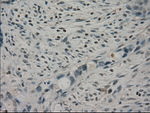 CRYAB Antibody in Immunohistochemistry (Paraffin) (IHC (P))