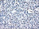 CRYAB Antibody in Immunohistochemistry (Paraffin) (IHC (P))