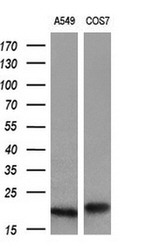 CRYAB Antibody in Western Blot (WB)