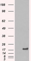 CRYAB Antibody in Western Blot (WB)