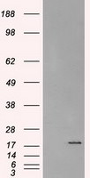 CRYAB Antibody in Western Blot (WB)