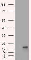 CRYAB Antibody in Western Blot (WB)