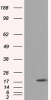 CRYAB Antibody in Western Blot (WB)